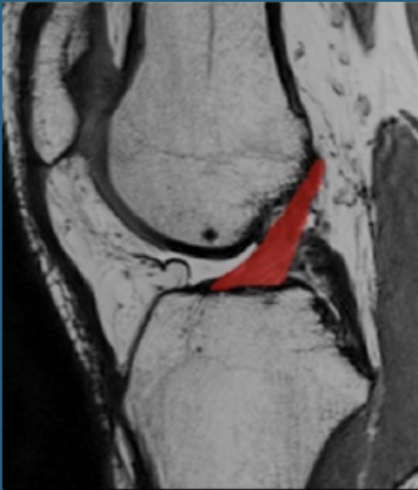 Screenshot 2025-11-30 at 11.12.50 PM.png